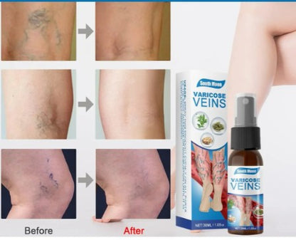 SPRAY VEINS VARICOSE (ADIOS VENAS VARICE) 120ML